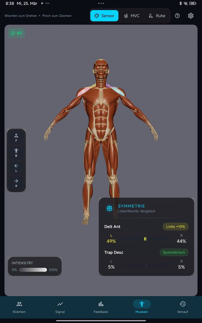 easyEMG-App auf Tablet: 3D-Muskel-Avatar mit Symmetrie-Vergleich links/rechts und MVC-Werten