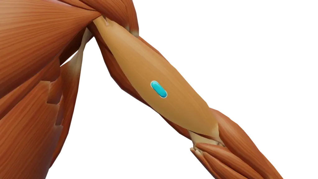 SENIAM-Elektrodenposition am M. Biceps brachii (3D-Muskeldarstellung)