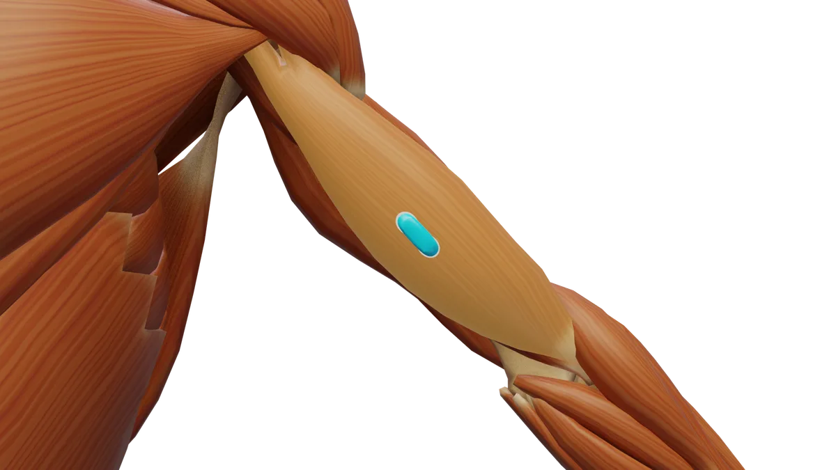 SENIAM-Elektrodenposition am M. Biceps brachii (3D-Muskeldarstellung)