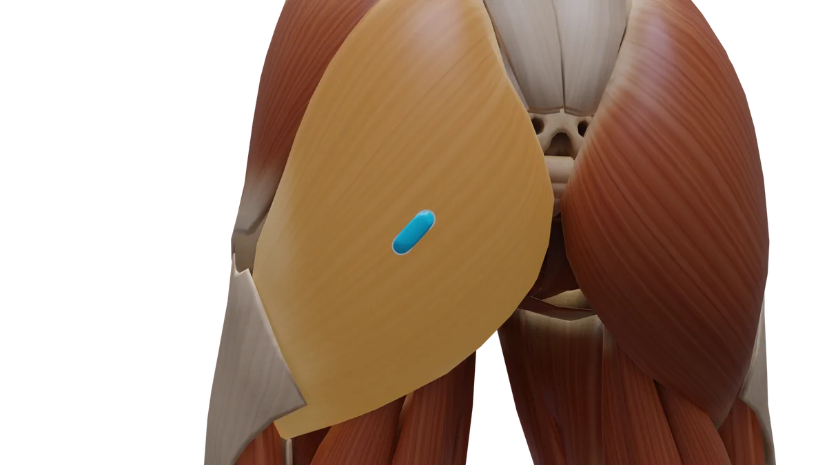 SENIAM-Elektrodenposition am M. Gluteus maximus (3D-Muskeldarstellung)