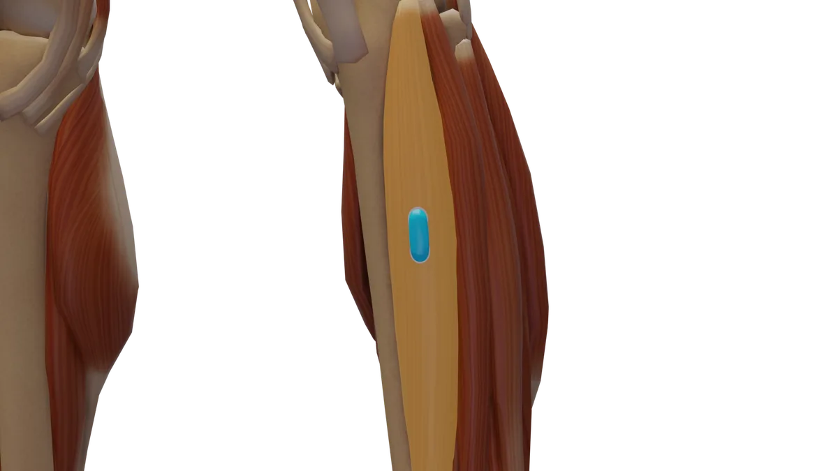 SENIAM-Elektrodenposition am M. Tibialis anterior (3D-Muskeldarstellung)