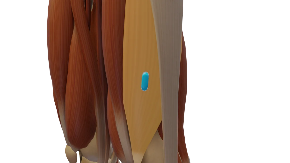 SENIAM-Elektrodenposition am M. Vastus lateralis (3D-Muskeldarstellung)