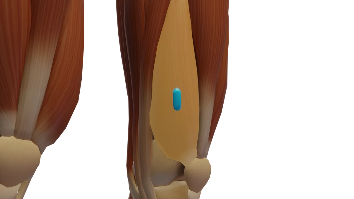 SENIAM-Elektrodenposition am M. Vastus medialis (3D-Muskeldarstellung)