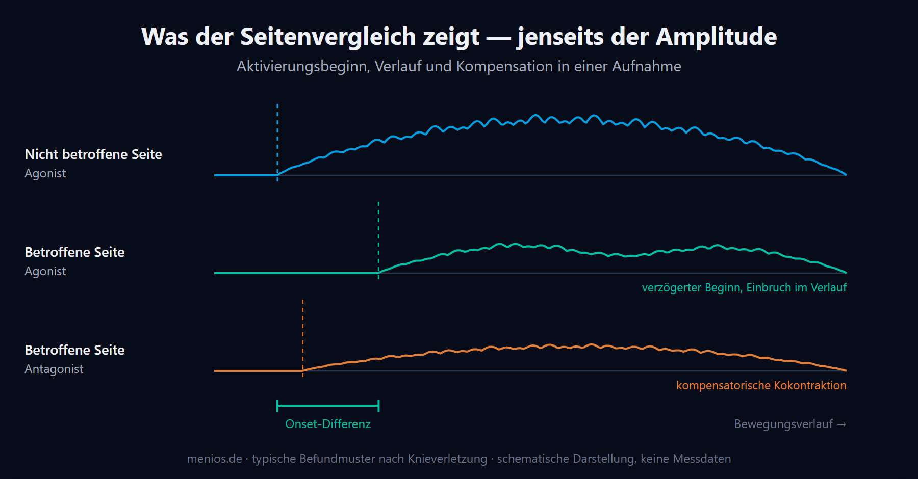 Drei Muster im EMG-Seitenvergleich: Onset-Verzögerung, Amplitudeneinbruch, Kokontraktion.