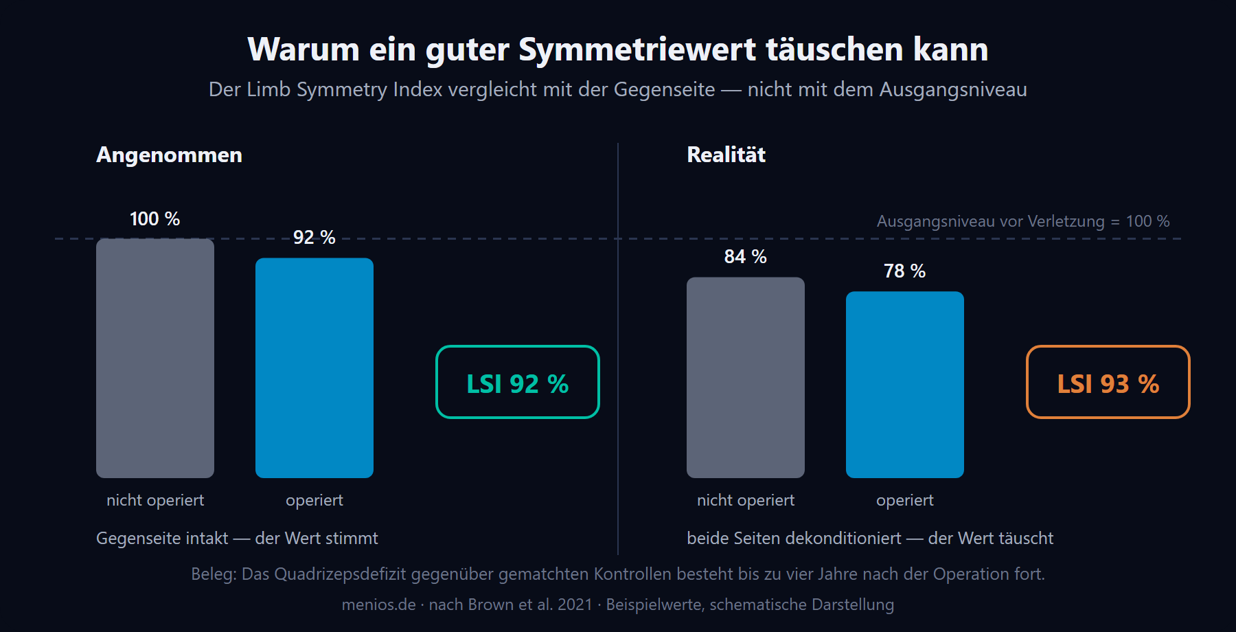 Der Limb-Symmetry-Index-Fehlschluss: hoher Symmetriewert trotz beidseitigem Kraftdefizit.