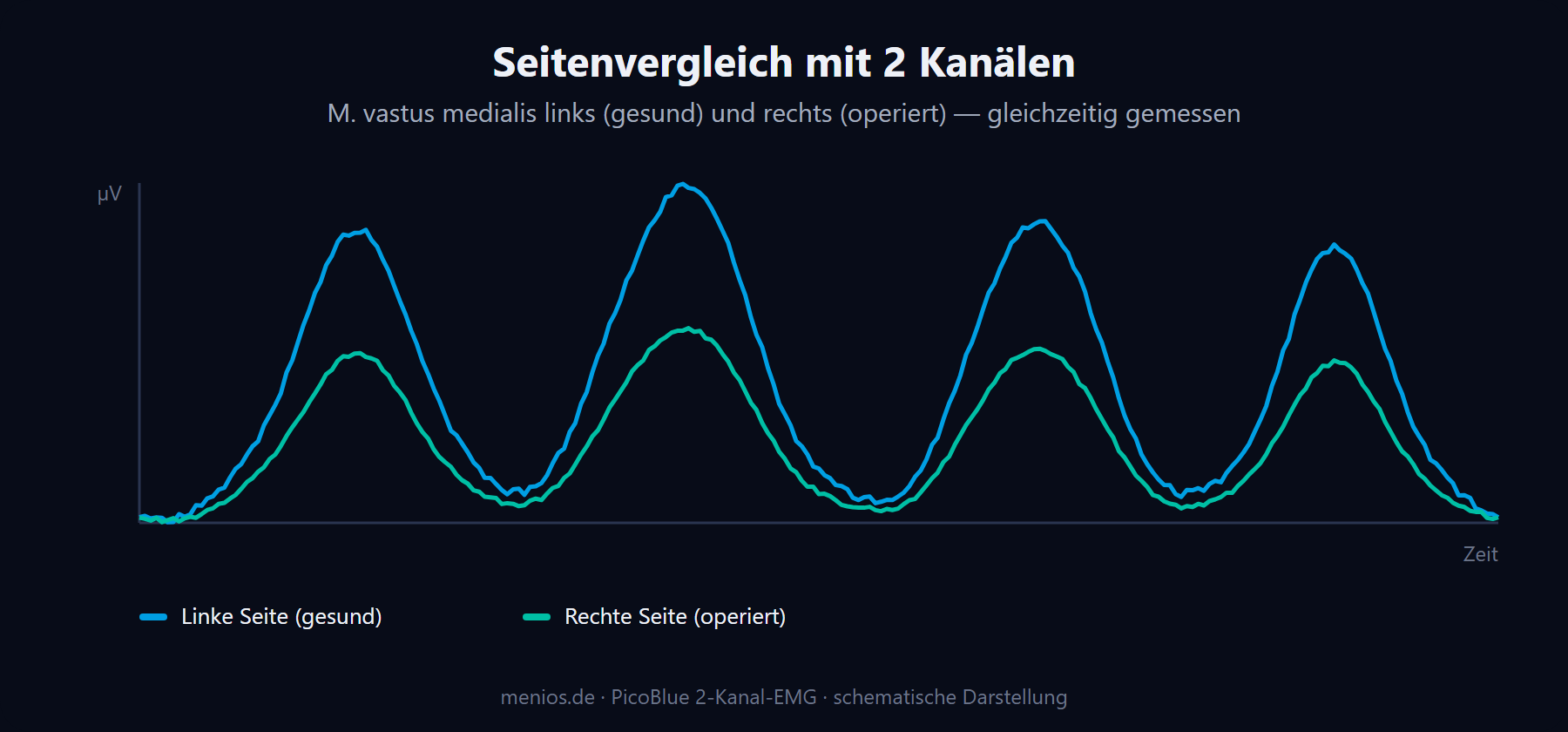 Seitenvergleich mit 2 Kanälen: geringere EMG-Amplitude der operierten Seite.