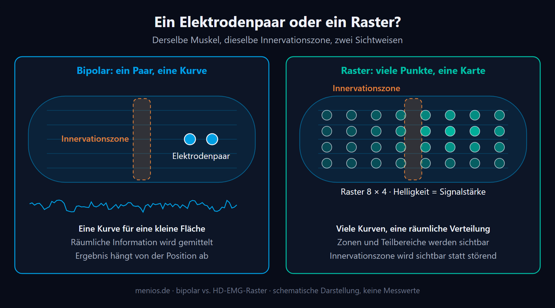 Links ein bipolares Elektrodenpaar mit einer Kurve, rechts ein 8×4-Elektrodenraster mit räumlicher Signalverteilung.