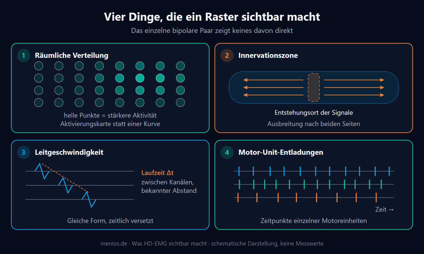 Vier schematische Felder: räumliche Verteilung, Innervationszone, Leitgeschwindigkeit, Motor-Unit-Entladungen.